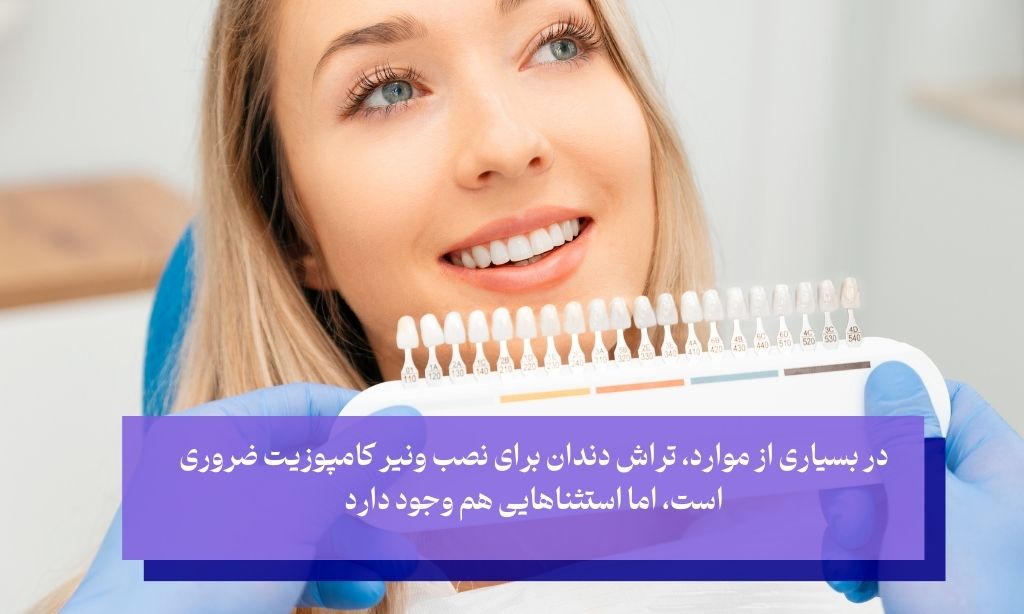 آیا می‌توان از تراش دندان برای کامپوزیت اجتناب کرد