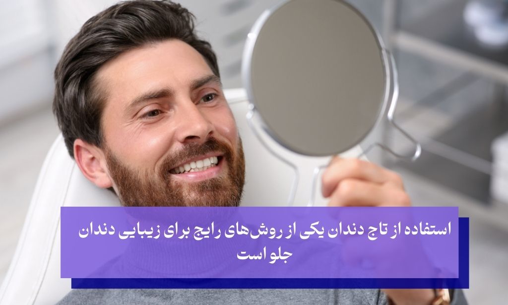 استفاده از تاج برای زیبایی دندان جلو