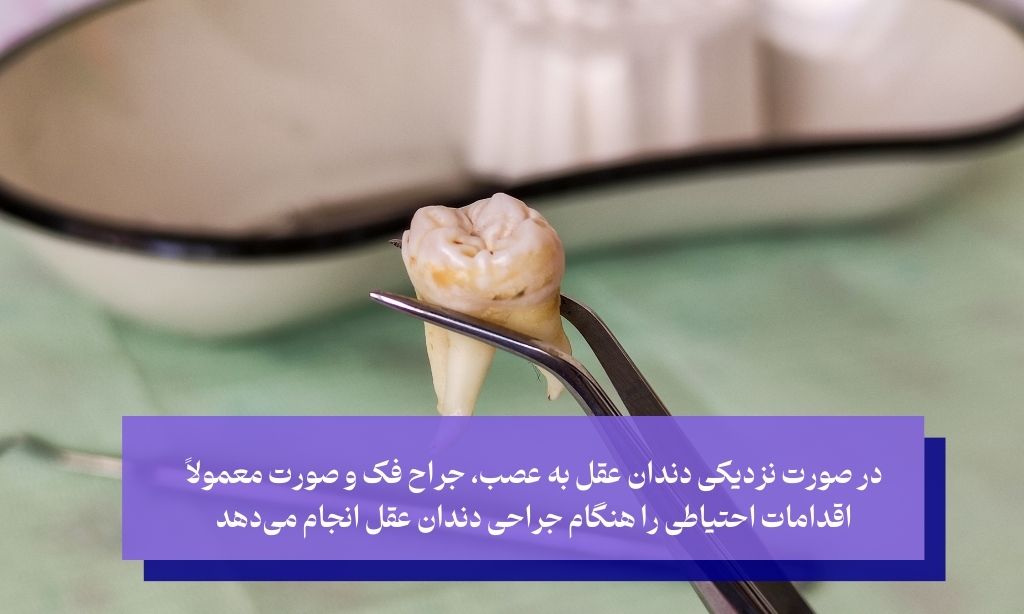 جراحی دندان عقل نهفته روی عصب