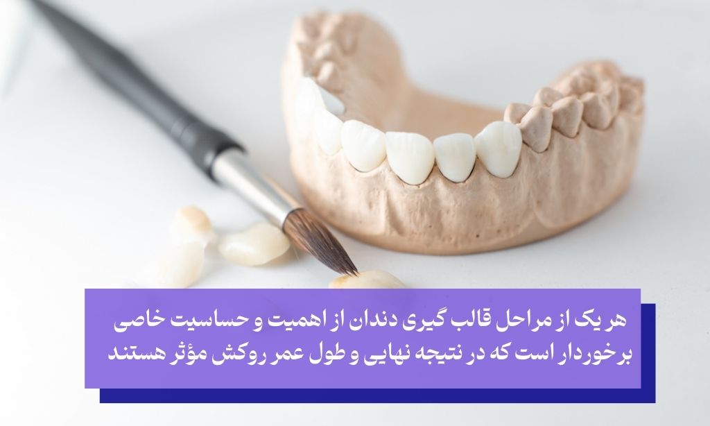 مراحل قالب گیری دندان برای روکش