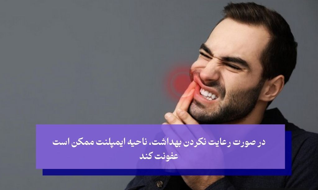 عوارض احتمالی کاشت دندان دائمی