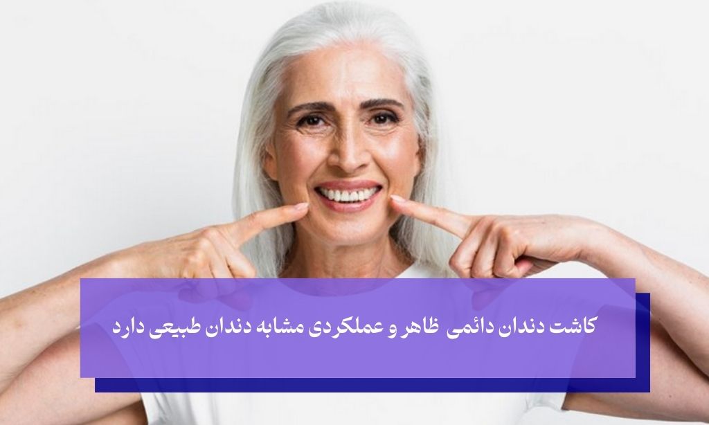 اهمیت کاشت دندان دائمی در سلامت دهان و دندان