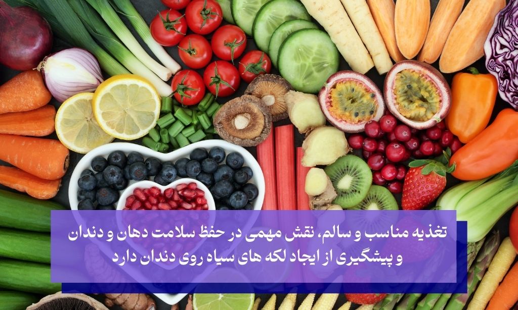 تغذیه مناسب؛ عاملی مهم در از بین بردن لکه های سیاه روی دندان