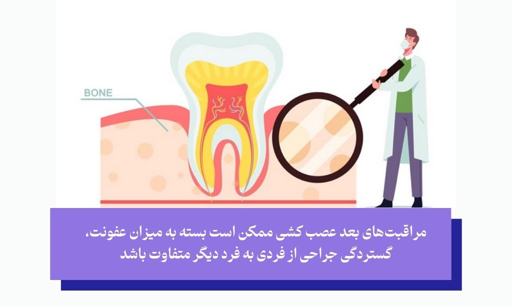 مراقبت‌های تکمیلی بعد از عصب کشی